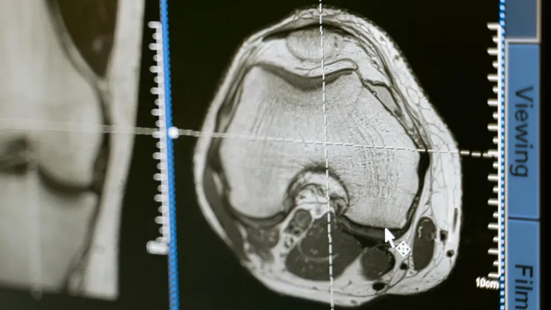 Artificial Intelligence in Healthcare